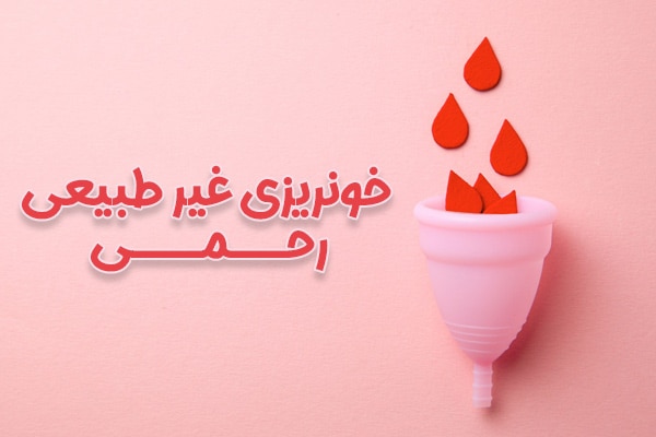 خونریزی غیر طبیعی رحم