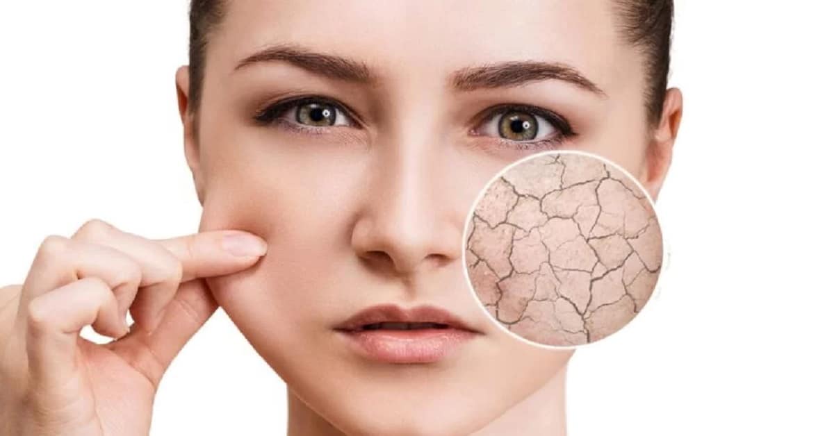 علت لکه های پوستی چیست؟